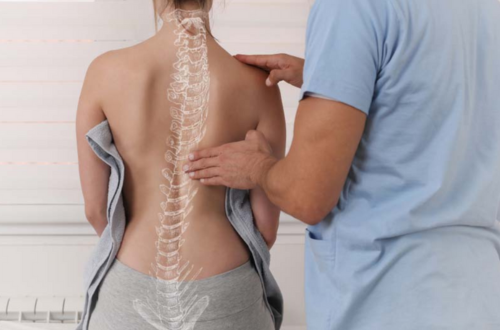 Scoliosis Kyphosis Surgery